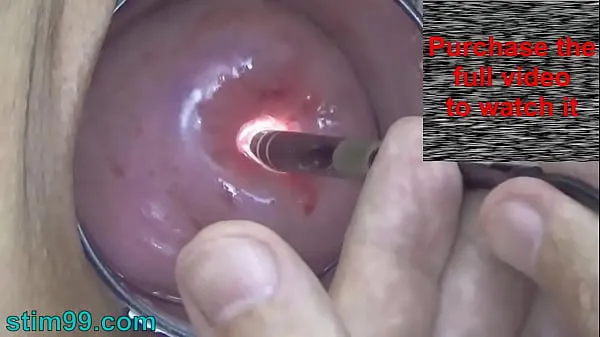 Novo Endoscopic Camera in Cervix watch inside my Womb and Vagina. Inspection testing exam of wife by extreme doctor gynecologist tubo de energia